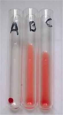 Comparison of Conventional Tube and Gel-Based Agglutination Tests for AB System Blood Typing in Cat